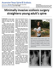 minimally invasive scoliosis surgery texas